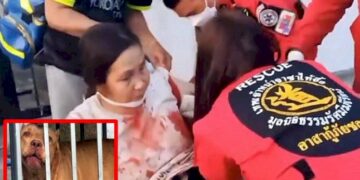 ลูกสาวรับ-แม่ถูก-“สุนัขพิทบูล”-ขย้ำจริง-แต่อาการไม่หนัก-เหตุยังไม่คุ้นชิน