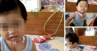 อดีต-สสชลบุรียื่นมือช่วย-ดช.ป่วยโรคหัวใจเขียว-ยอดบริจาคทะลุ-200,000-บาทแล้ว