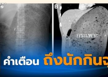 ฝนตกถนนลื่น-ขี่รถ-จยย.-ลื่นล้มกลางถนน-ถูกรถบรรทุกทับเสียชีวิต