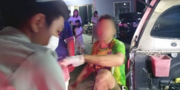 เพื่อนร่วมงานโหด!-ฟันนิ้วเกือบขาด-ฉุนโดนต่อว่า