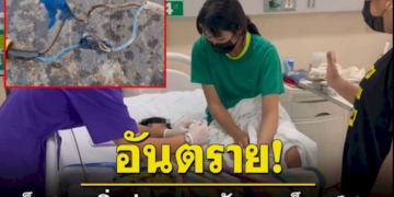 หวิดเกิดเหตุสลด!เด็ก-3-ขวบวิ่งเล่นชายหาดมือไปจับราวเหล็กสแตนเลสถูกไฟดูดเจ็บ